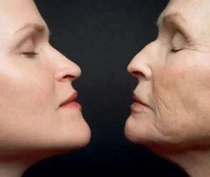 Comparative Facial Analysis Demonstrating NMN's Cellular Age-Reversal Effects