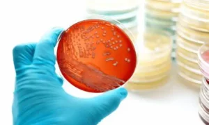 microbial-preservation-media-gellan-gum-hylixchem